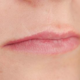 makijaz-permanentny-ust-przed-2